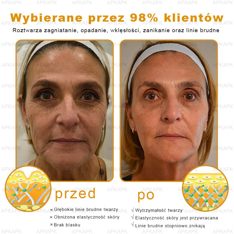🎁 Zostało już tylko 5 pudełek! Teraz dajemy dodatkowe 50% zniżki! Bądź fit i zdrowy.